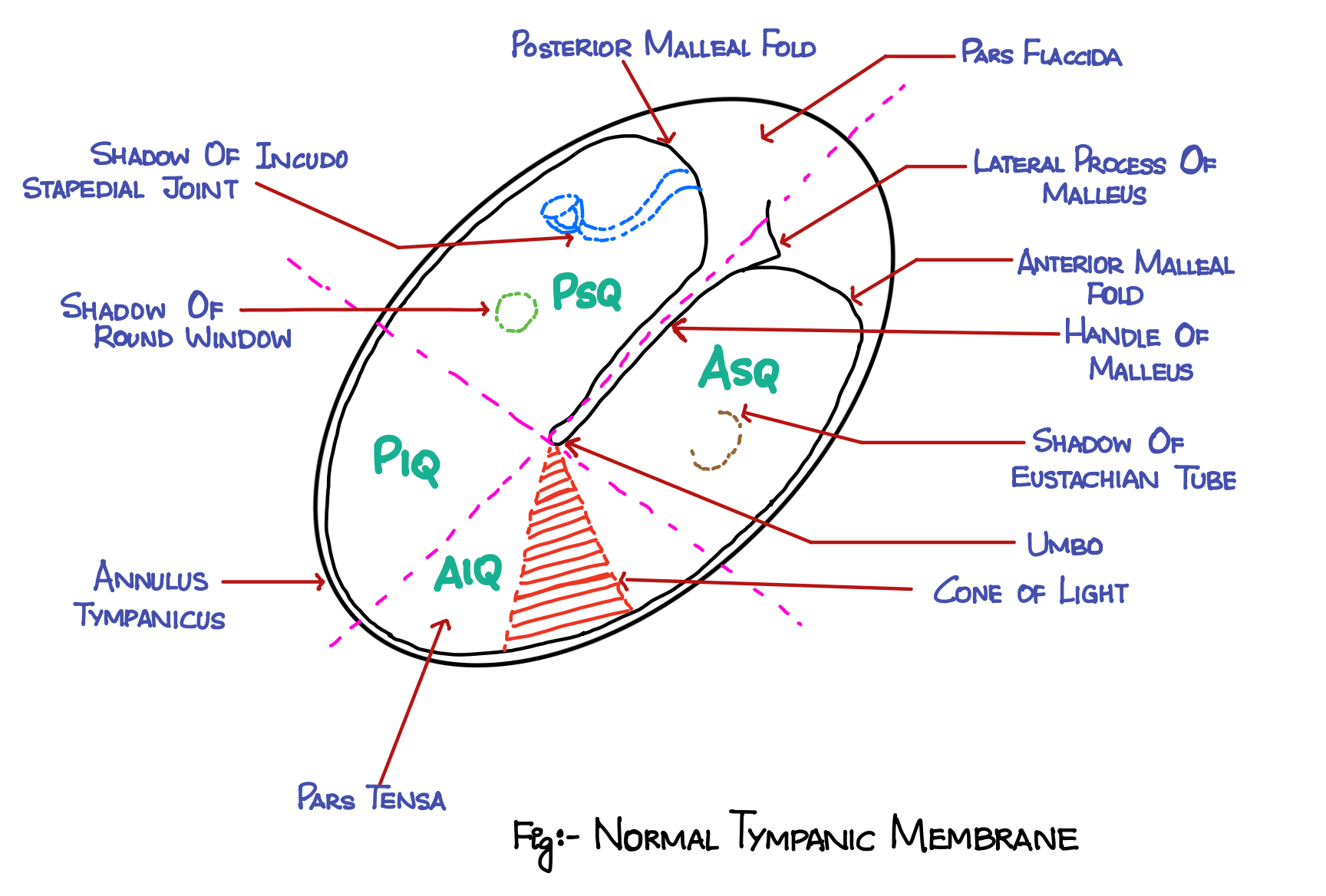 Normal Tympanic Membrane